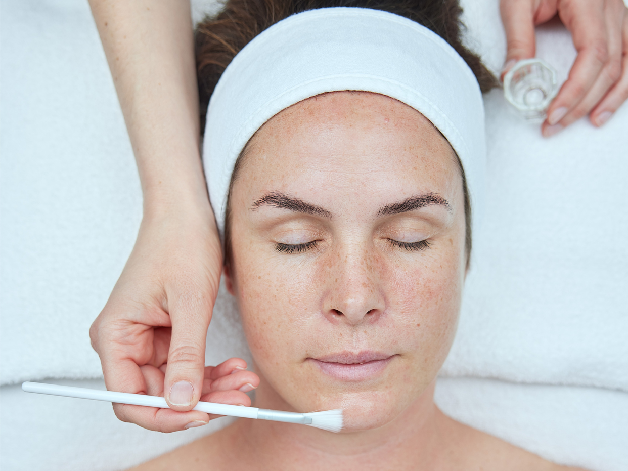 Billede af kvinde, der får en NEOSTRATA-behandling med kemisk peeling.