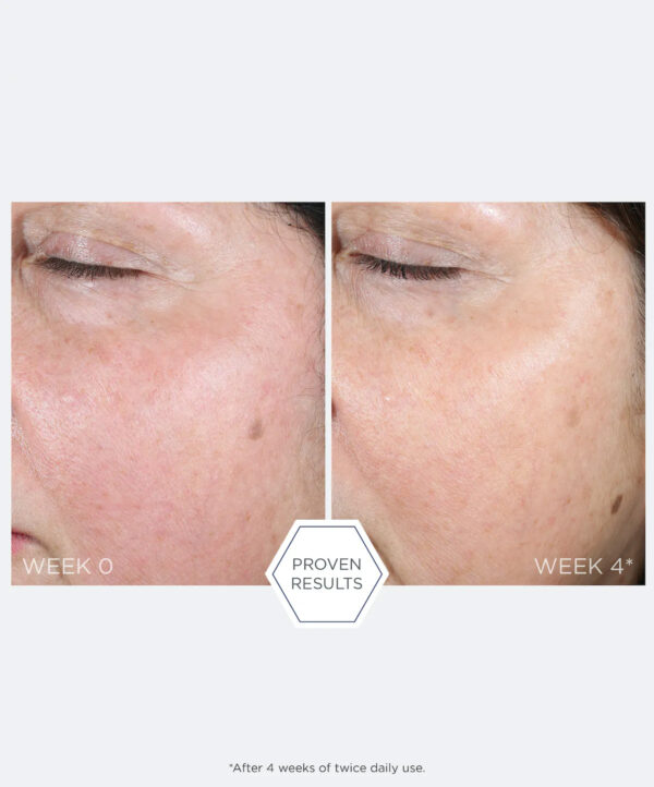 30273_neostrata_restore_pha_renewal_pads_v5.jpg 30273_neostrata_restore_pha_renewal_pads_v5.jpg